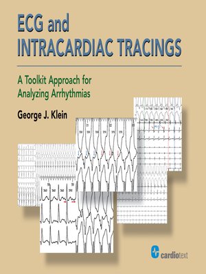 cover image of ECG and Intracardiac Tracings